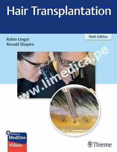 Hair Transplantation