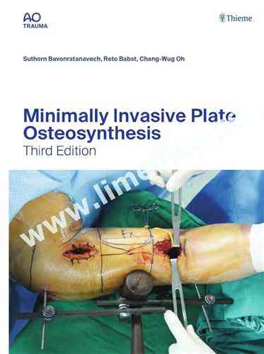 Minimally Invasive Plate Osteosynthesis