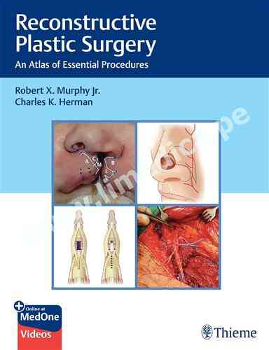 Reconstructive Plastic Surgery An Atlas of Essential Procedures