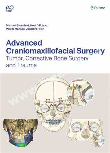 Advanced Craniomaxillofacial Surgery Tumor  Corrective Bone Surgery, and Trauma