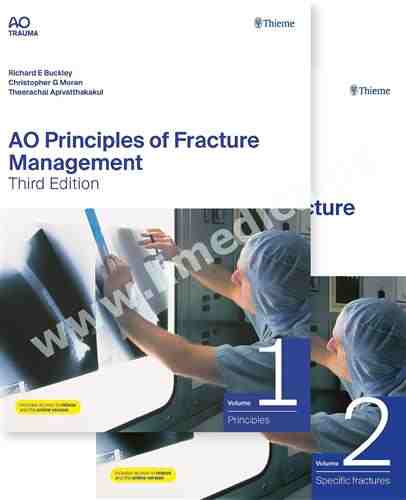 AO  Principles of Fracture Management Vol   1   Principles  Vol 2  Specific fractures