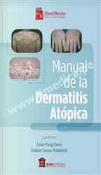 Manual De La Dermatitis Atópica 