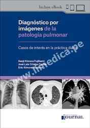 Diagnóstico por imágenes de la patología pulmonar