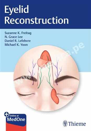 Eyelid Reconstruction