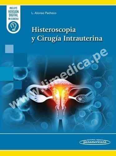 Histeroscopia y Cirugía Intrauterina