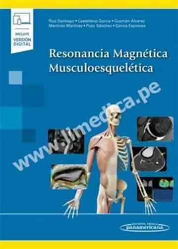 Resonancia Magnética Musculoesquelética