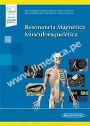 Resonancia Magnética Musculoesquelética