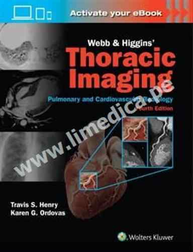 Webb   Higgins Thoracic Imaging: eBook with Multimedia