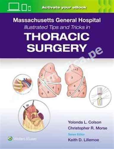 Massachusetts General Hospital Illustrated Tips and Tricks in Thoracic Surgery