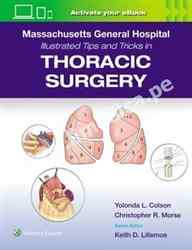 Massachusetts General Hospital Illustrated Tips and Tricks in Thoracic Surgery