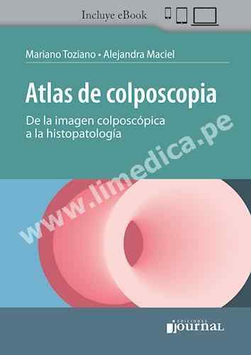 Atlas de colposcopia