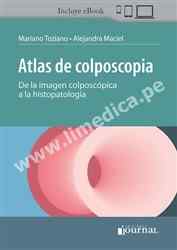 Atlas de colposcopia