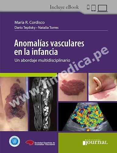 Anomalías vasculares en la infancia