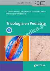 Tricología en Pediatría