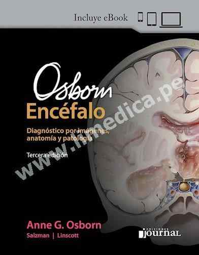 Osborn. El Encéfalo